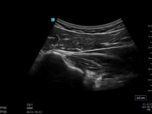 Urotech Hybrid Pro Technology image cover