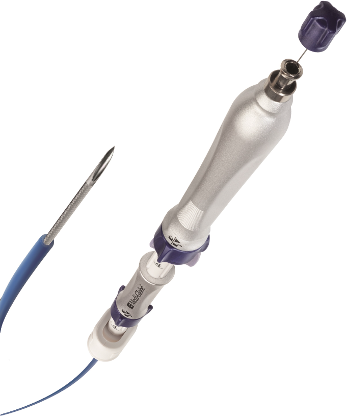 EBUS Transbronchial Needle Aspiration (TBNA) image