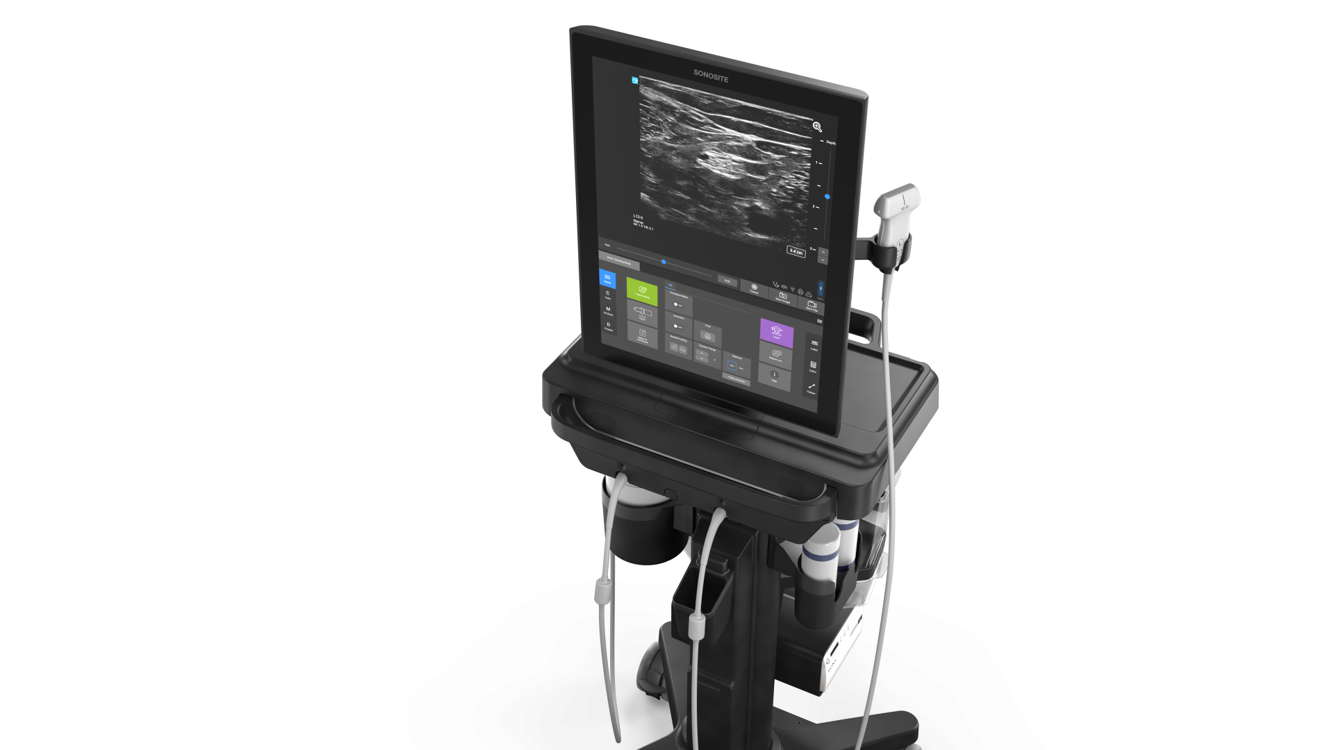 Sonosite ST image cover