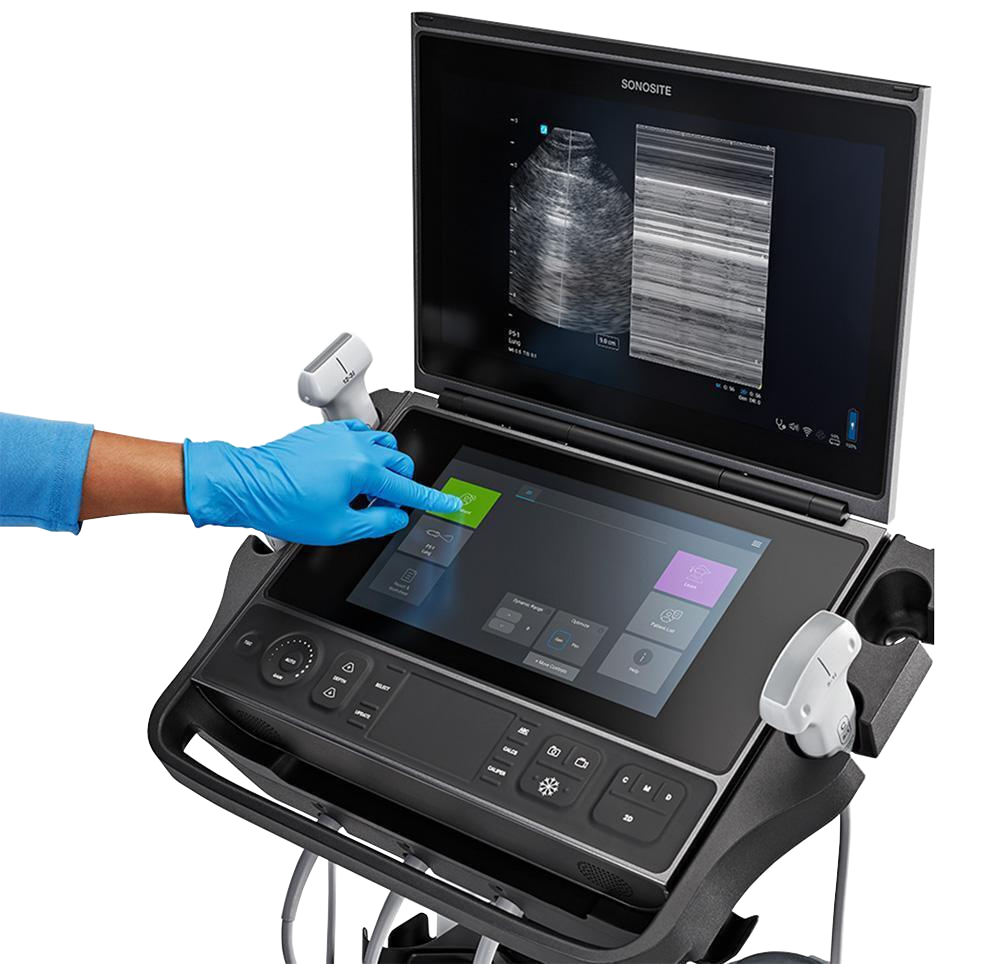 Sonosite PX image cover