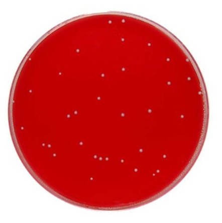Columbia  Blood Agar image cover