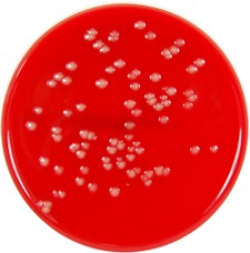COLUMBIA AGAR + SHEEP BLOOD image cover