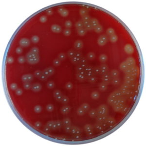 Streptococcus Medium image cover