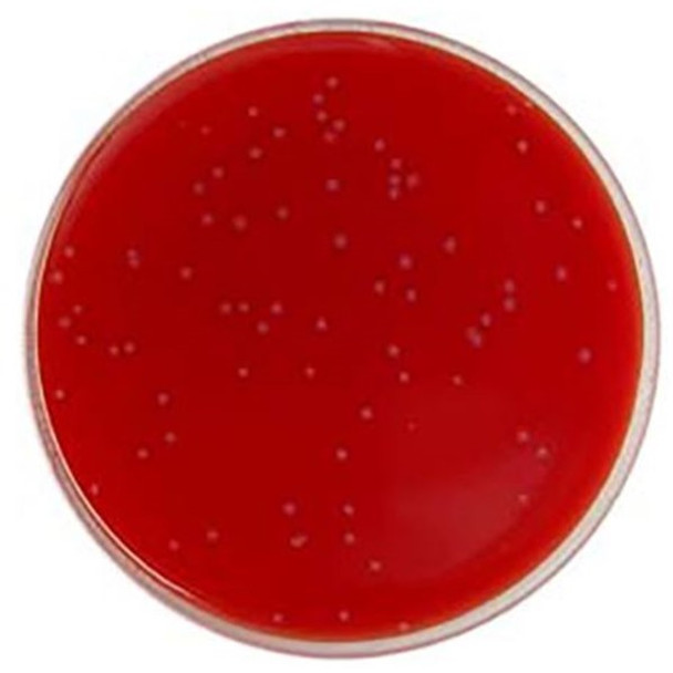 FASTIDIOUS ANAEROBIC AGAR + HORSE BLOOD image cover