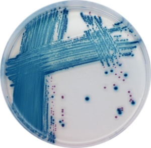 CHROMagar STEC image cover