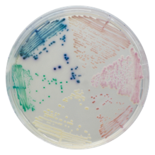 CHROMagar Candida image cover
