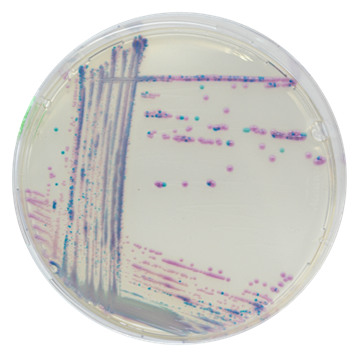 CHROMagar Staphylococcus aureus image cover