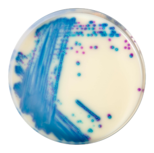 CHROMagar VRE image cover