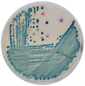 CHROMAGAR mSUPERCARBA  AGAR image cover