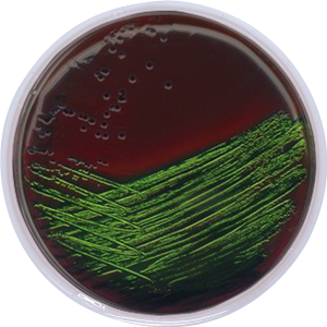 E.M.B. EOSIN METHYLENE BLUE AGAR (Modified) Levine image cover