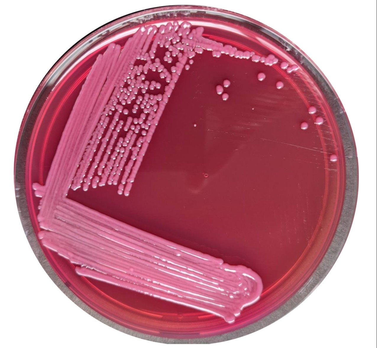 MacConkey Agar image cover
