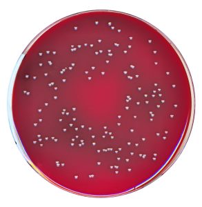 Fastidious Anaerobic Agar + NEO + NAL image cover