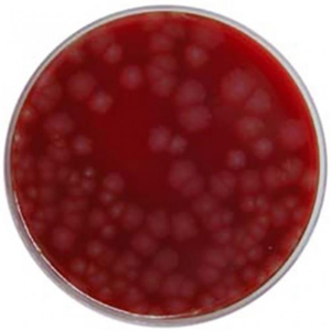 Fastidious Anaerobic Agar + Neomycin image cover
