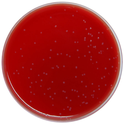 Fastidious Anaerobic Agar + 5% Sheep Blood image cover